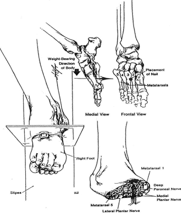 A series of detailed anatomical drawings depicting aspects of human feet and lower leg crucifixion. The primary image shows a side view of the crucifixion, emphasizing the weight-bearing direction of the body and nail placement. Other illustrations include frontal and medial views of a foot highlighting the metatarsals and nervous system, as well as a closer view of another foot from below, showing the distribution of nails and anatomy of the crural region.
