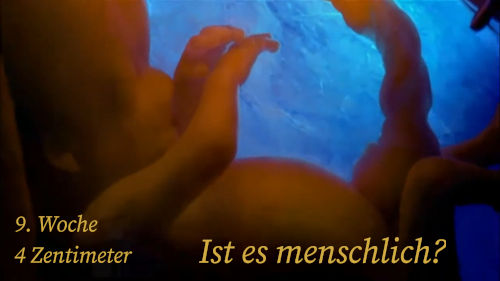 Ultraschallbild einer menschlichen Entwicklung, in der 9. Schwangerschaftswoche, zeigt ein 4 Zentimeter großes Embryo. Der Text "Ist es menschlich?" erscheint am Bildrand.