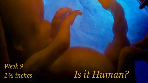An ultrasound image displaying a 9-week old embryo, approximately 1 and 1/2 inches in length, alongside the text "Is it Human?".